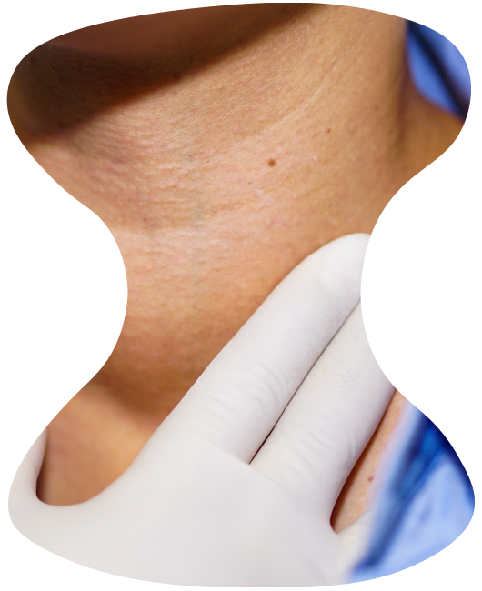 A doctor examines a patient with goiter.