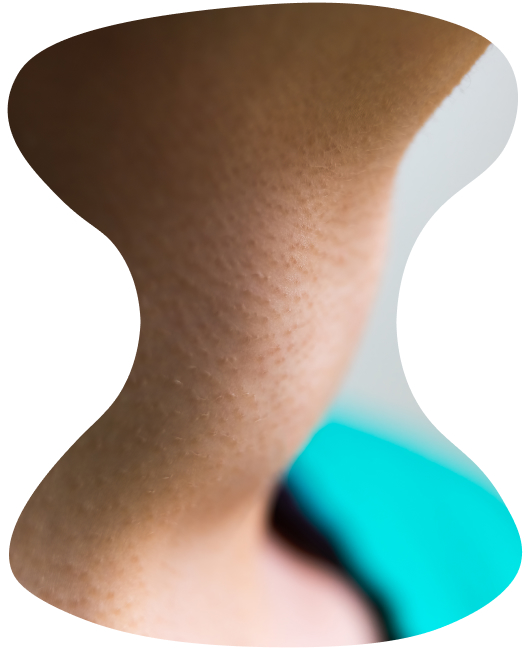 Close up view of a patient with Hyperthyroid.